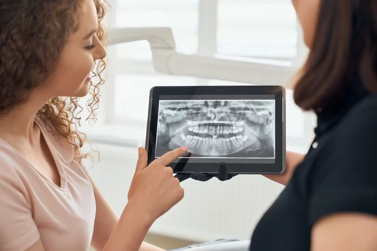 3d dental imaging blog image